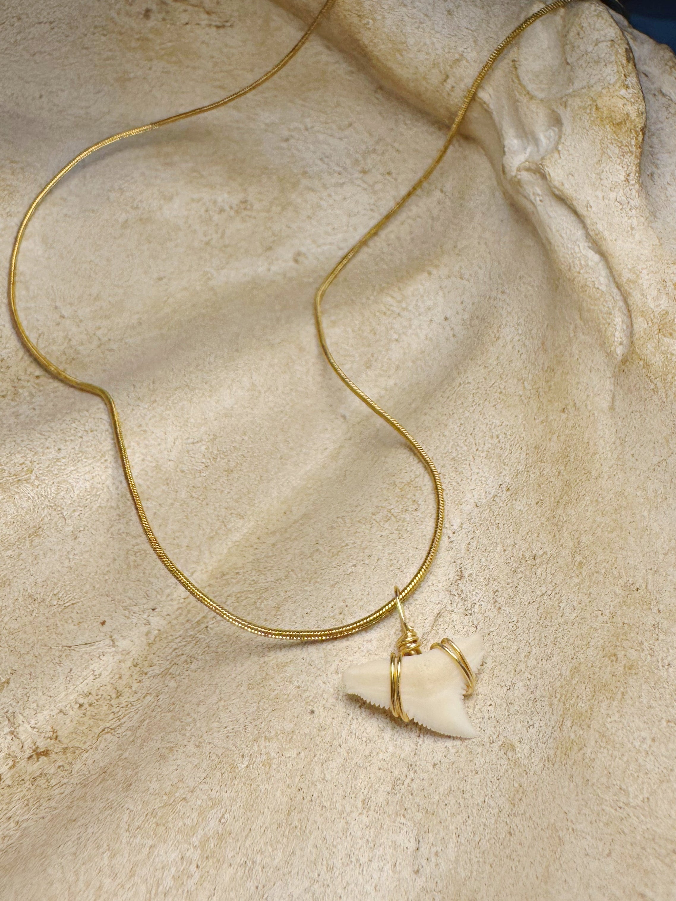 Gold Tooth